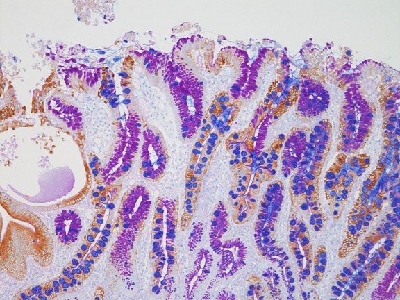 Immunohistochemistry