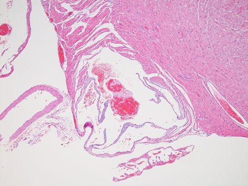 Pulmonary vein valve, HE staining