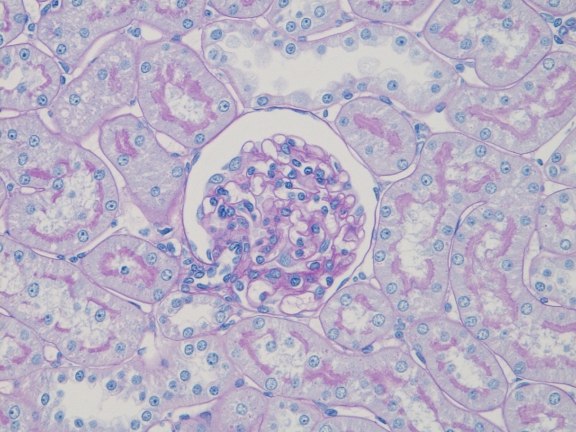 Glomerulus